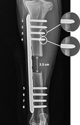 Temporal Changes in Reverse Torque of Locking-Head Screws Used in the Locking Plate in Segmental Tibial Defect in Goat Model